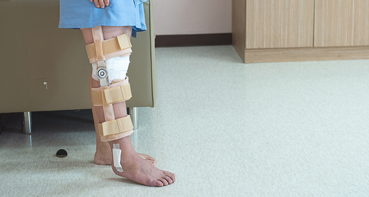 What to Expect Before and After ACL Reconstruction