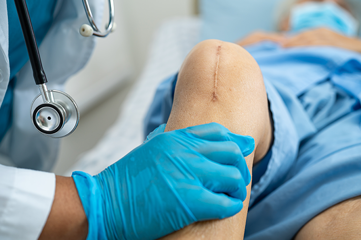 Risks of Knee Replacement Surgery