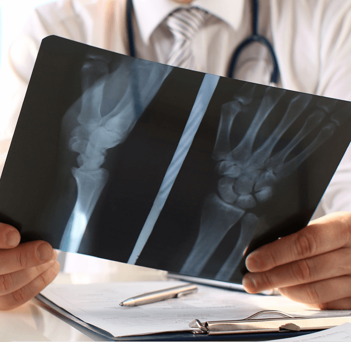 Types of Orthopaedic Trauma Injuries
