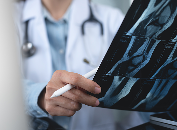 FAQs About Knee Replacement Surgery