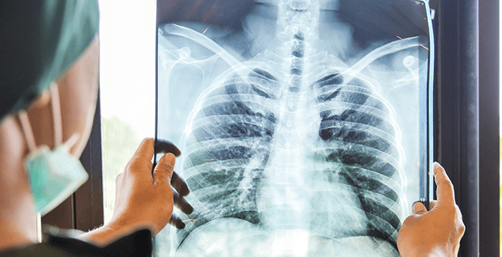 Risks of Frozen Shoulder Surgery